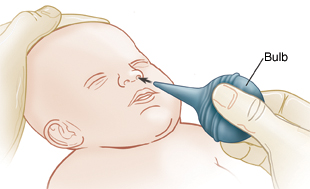 using bulb syringe baby nose