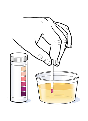 Discharge Instructions Checking For Ketones Saint Luke S Health System