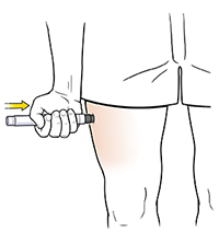 Hand pressing EpiPen to side of thigh.