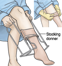 Putting on Compression Stockings