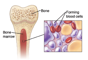 Foods That Assist Keep The Bone Marrow Healthy Healthdigezt Com