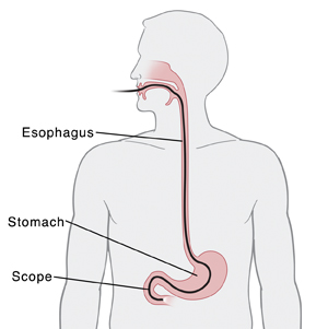 Endoscopic Ultrasound (EUS) | Saint Luke's Health System