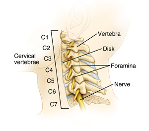 Cervical Disk Problems | Saint Luke's Health System