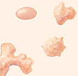 Illustration showing various shapes of kidney stones.