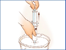 Gastrostomy Feeding Tube Care Flushing Saint Luke S Health System