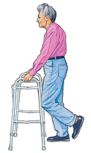 Discharge Instructions: Using a Walker | Saint Luke's Health System