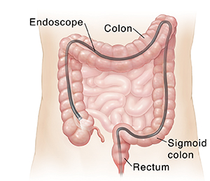 About the Lower GI Tract - NIDDK