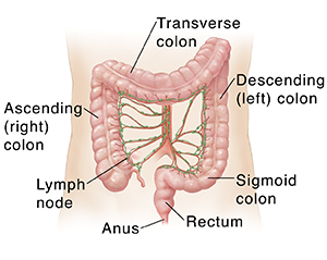 What Is Colon And Rectal Cancer Colorectal Cancer Saint Luke S Health System