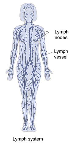 What is Non-Hodgkin Lymphoma? | Saint Luke's Health System