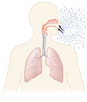 How To Prevent The Spread Of Tuberculosis Saint Luke S Health System