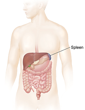 Causes of Spleen Pain