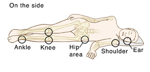 Outline of person lying on side with bones visible. Circles indicate pressure points: Ear, shoulder, hip area, knees, ankle.