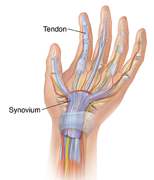 Palm of hand showing tendons, bones, muscles, arteries, nerves.