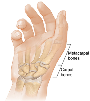 Metacarpalis carpal artrosis kezelés. Kézközépcsont – Wikipédia