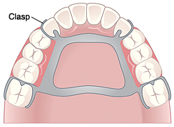 Health connector dental