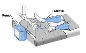 Compression device