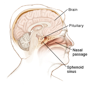 Pituitary tumors and dizziness