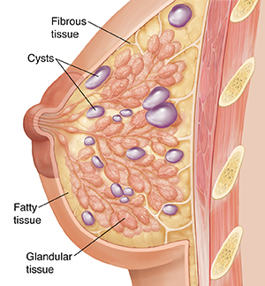 https://api.kramesstaywell.com/Content/6066ca30-310a-4170-b001-a4ab013d61fd/ucr-images-v1/Images/side-view-cross-section-of-breast-showing-glandular-fibrous-and-fatty-tis