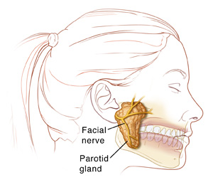 Side view of a female head showing the parotid gland and facial nerve next to the ear and over the jaw.