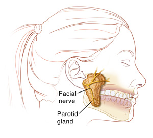 Parotidectomy | Saint Luke's Health System