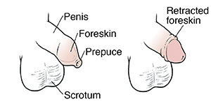 Your Whole Baby on X: Does your doctor say your child has phimosis? Sex  characteristics change in form and function as a child grows and matures.  The natural, non-retractable state of a