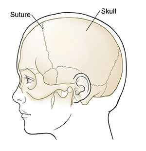 Of skull signs fracture basilar 5 signs