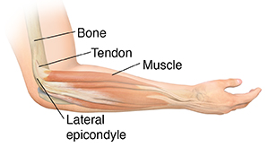 Understanding Lateral Epicondylitis Saint Luke S Health System