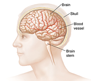 Types of head injury