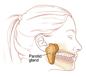 Understanding Parotid Duct Obstruction | Saint Luke's Health System