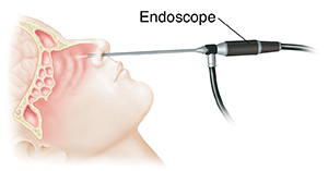 nose camera scope