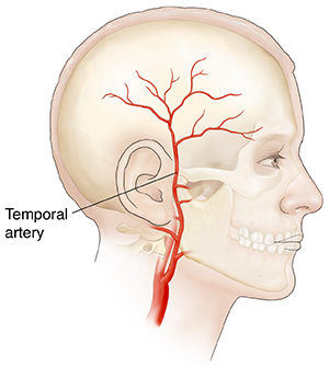 Side view of head showing the temporal artery.