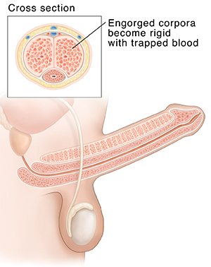 Penis Erection Stages 118