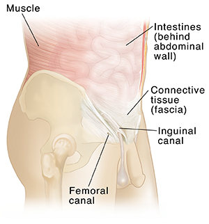 Defined anatomic locations of the suprapubic area (A), groin (B