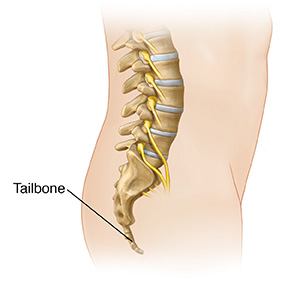 Tailbone (Coccyx) Fracture  Saint Luke's Health System