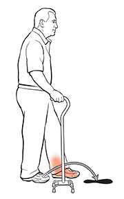 Using a Cane | Saint Luke's Health System