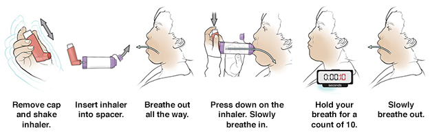 can you use ventolin and albuterol together