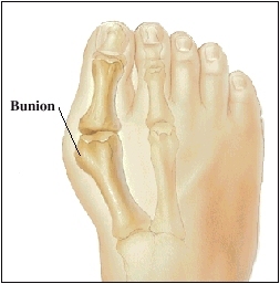 Big Toe Bones Diagram