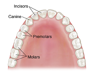 Top view of child's upper jaw showing permanent teeth.