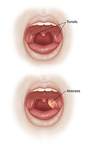 Tonsils after giving oral