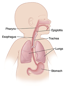 newborn aspiration