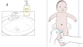 Step-by-Step: Caring For Your Newborn Circumcision