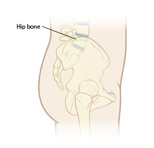 Bone Marrow Aspiration And Biopsy Saint Luke S Health System