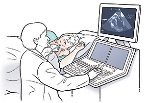 Woman wearing hospital gown lying on exam table on side. Health care provider is holding echocardiogram probe to woman's chest and looking at monitor.