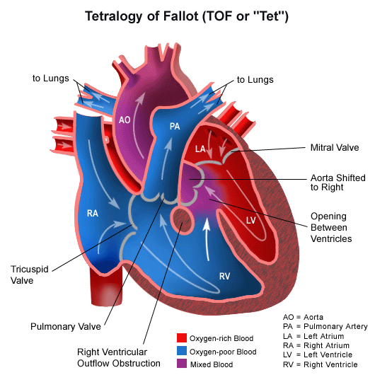 normal heart blood flow - Dayton Children's Hospital