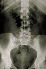 Lumbar X-ray X-ray image of the back and pelvis