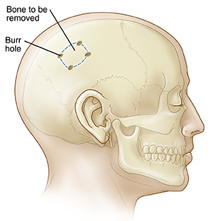 The Way You Walk Is Tied to a Hole in Your Skull