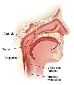 Side view cross section of head showing nose, throat, and sinus anatomy.