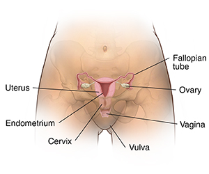Front view of woman's pelvis with pelvic bones ghosted in, showing cross section of uterus, ovaries, and fallopian tubes.