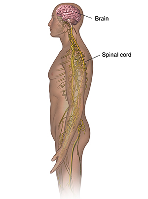 ALS: What Is Lou Gehrig's Disease? - University Health News