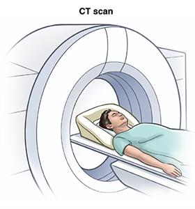 How Painful Is A Compression Fracture? - Hadi Medical Group